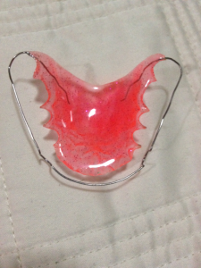 My new hot pink glittery retainer